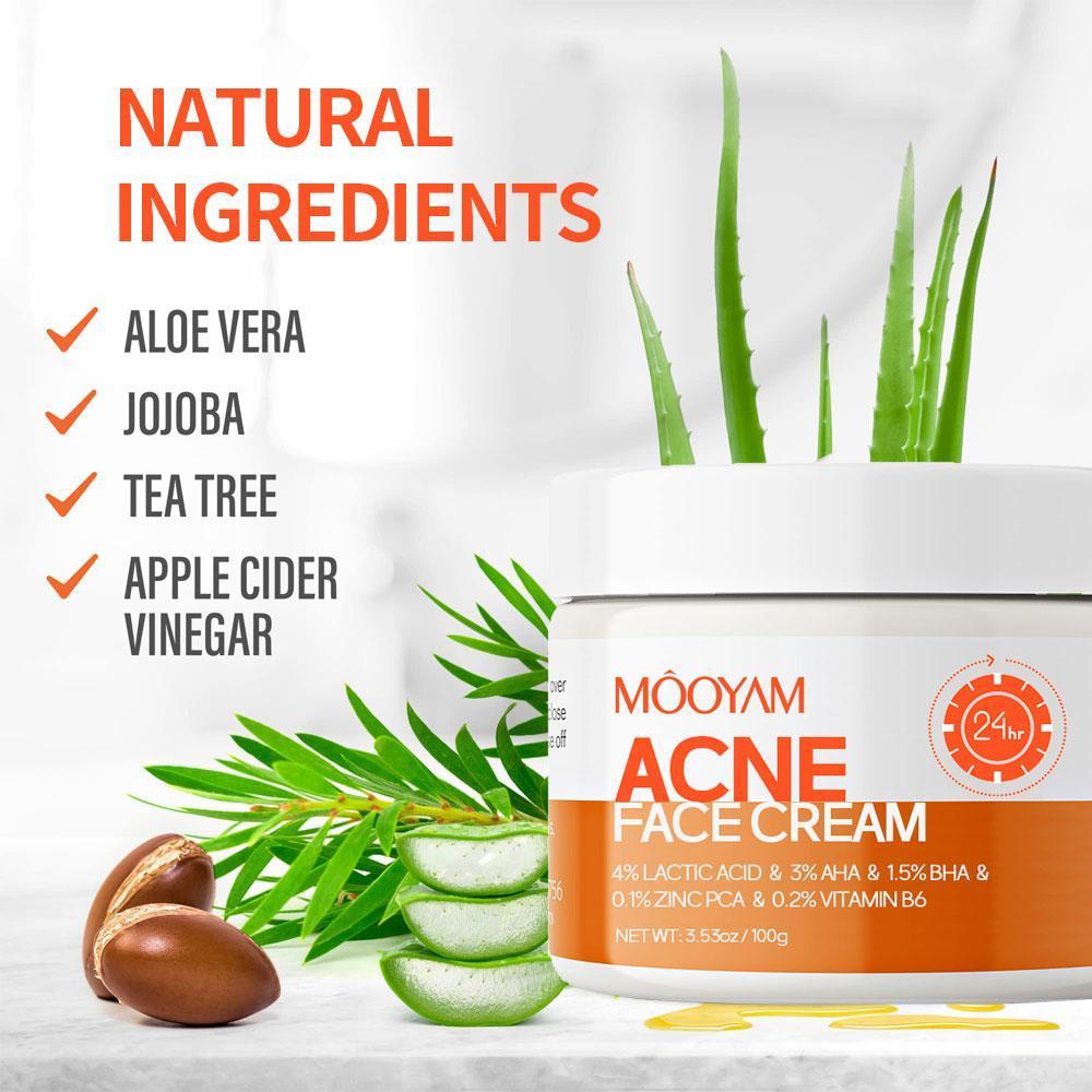 MOOYAM ACNE FACE CREAM