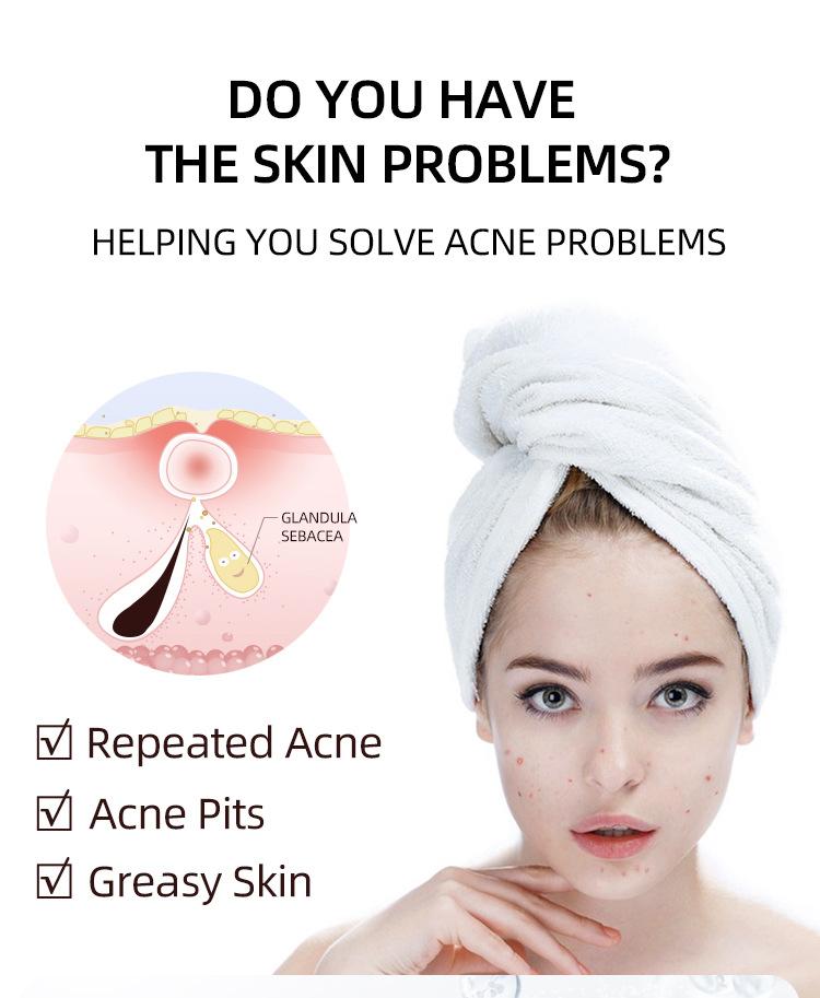 Acne Remover Gel Scar Blackhead Acne Moisturizer