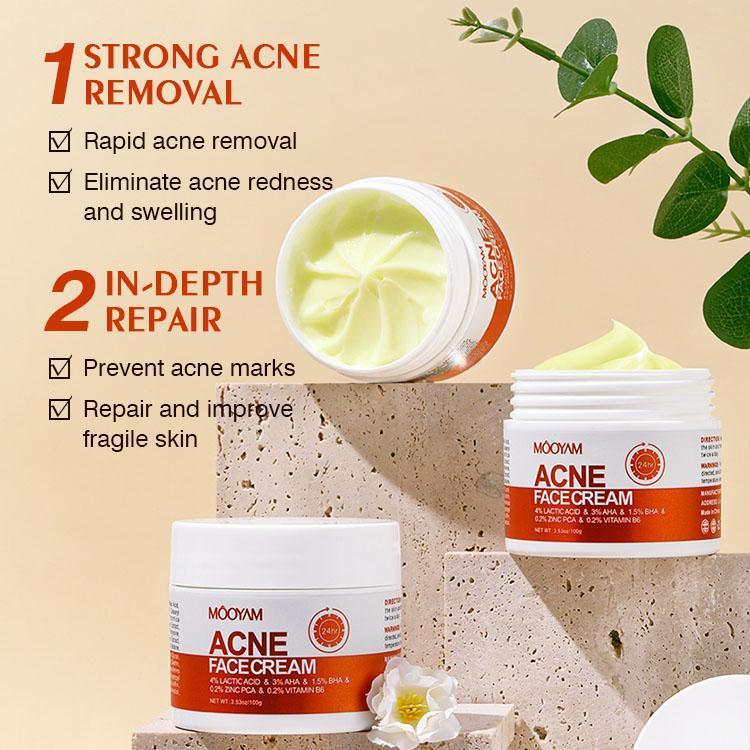 MOOYAM ACNE FACE CREAM